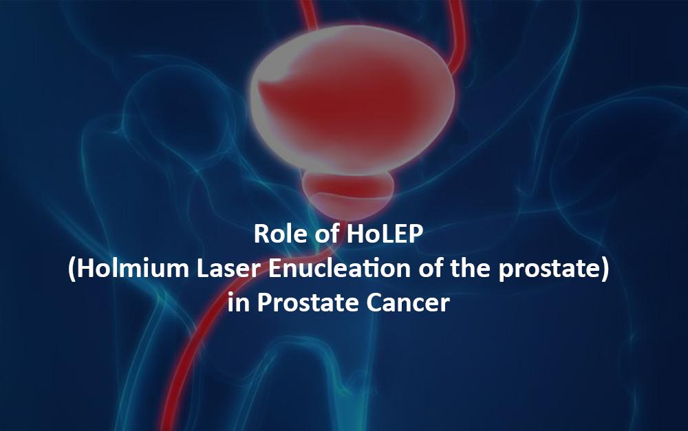 Holep Treatment In India For Prostate Cancer Hospitals Hbg