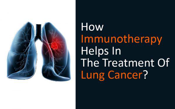 Immunotherapy treatment for lung cancer in India Best