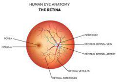 detached retina symptoms causes